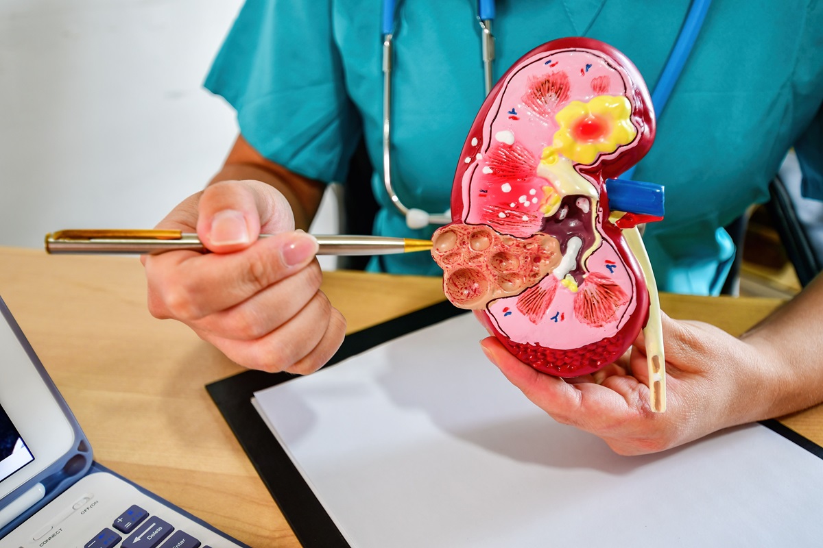 Kidney Doctor in Toledo